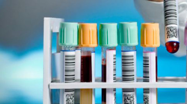 allergy-testing.jpg